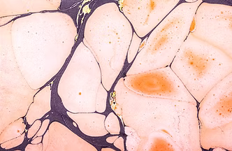 Abstract Surface